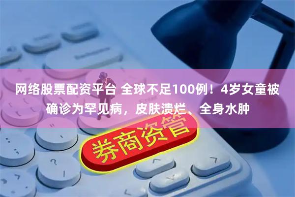 网络股票配资平台 全球不足100例！4岁女童被确诊为罕见病，皮肤溃烂、全身水肿